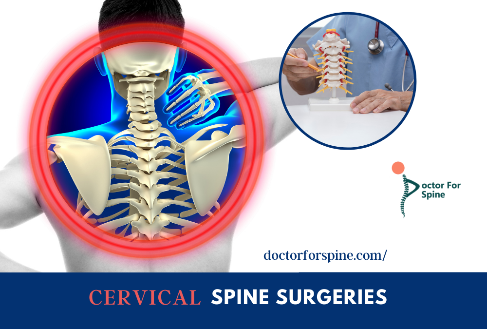 Cervical Spine Surgeries