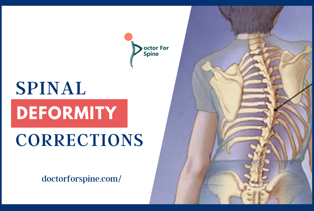 Spinal Deformity Corrections